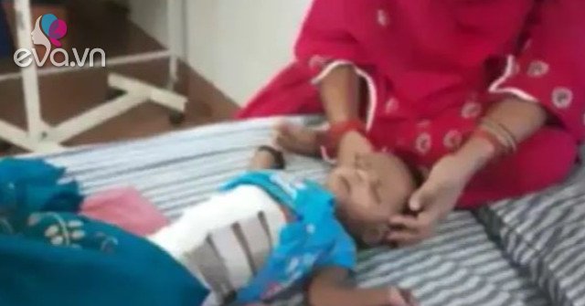 40-day-old son has unusual abdominal distension, parents are shocked when they see what’s in the stomach