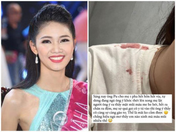 Á hậu Việt Nam 2016 Thanh Tú hoảng hồn khi con trai chảy máu mũi giữa đêm