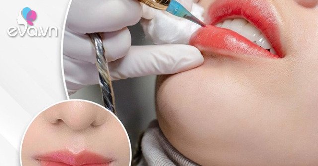 What is a biological lip implant?  What do experts say about the method of removing dark lips?