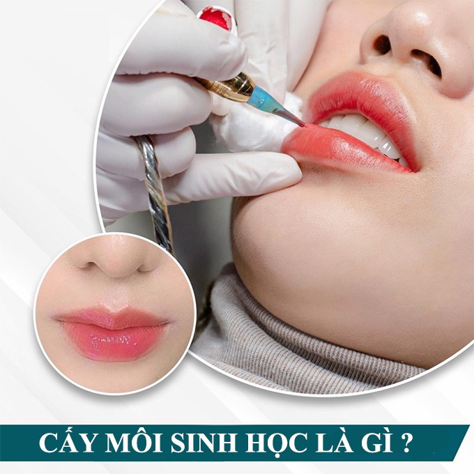 What is a biological lip implant?  What experts say about the method of removing dark lips - 3