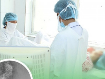 “Vùng kín” con gái 12 tuổi có mùi khó chịu, tới viện mẹ hoảng hồn khi phát hiện thứ bên trong