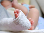 Sức khỏe - Bé trai Hà Nội nát bàn chân vì bố chủ quan với thiết bị hiện đại nhiều nhà ưa chuộng