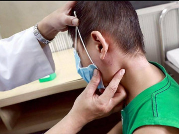 Sự thật ít ngờ về vi khuẩn “ăn thịt người” Whitmore, triệu chứng và cách phòng bệnh