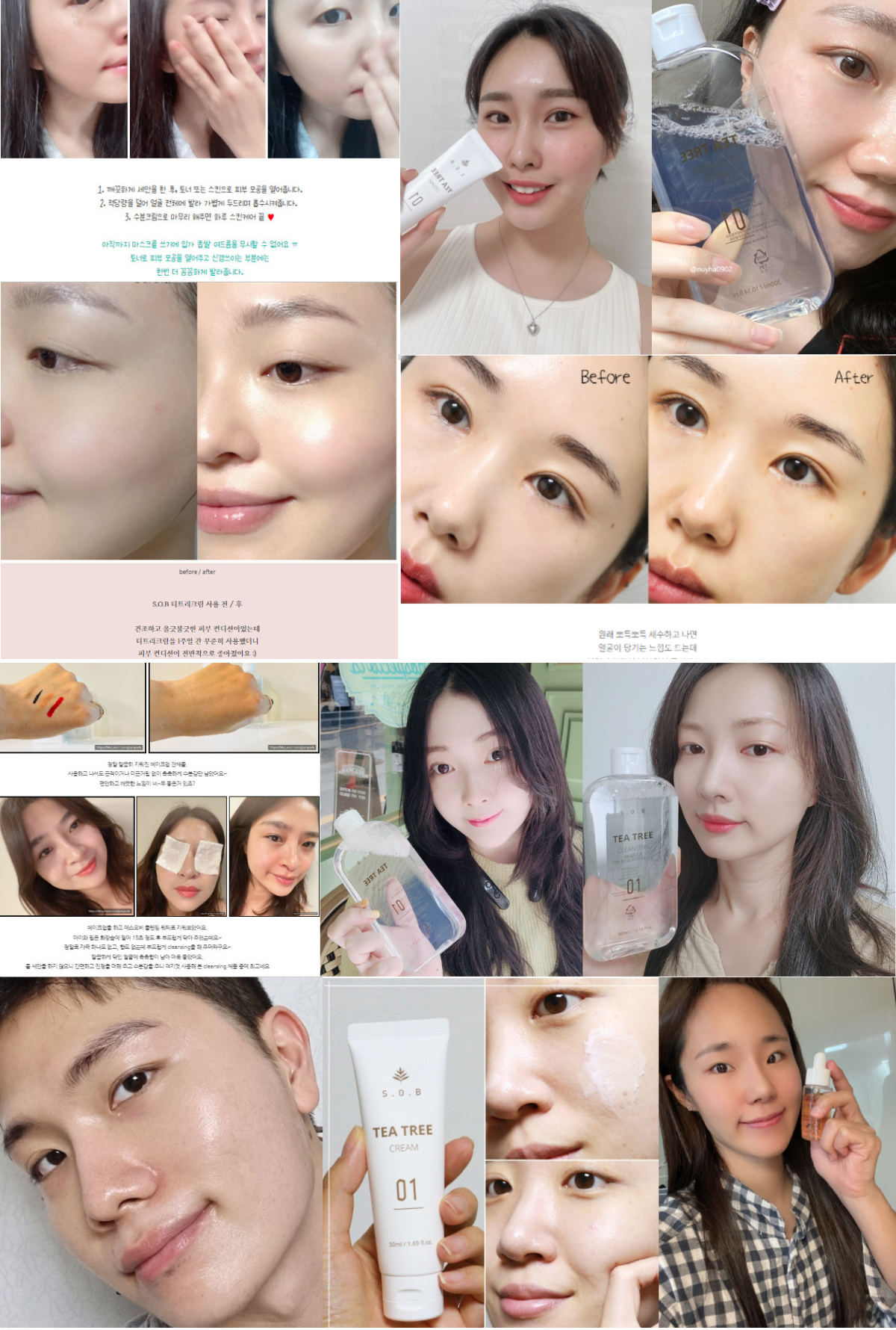 Hàng loạt beauty blogger Hàn - Việt “đổ gục” trước bộ chăm sóc da mụn S.O.B - 1