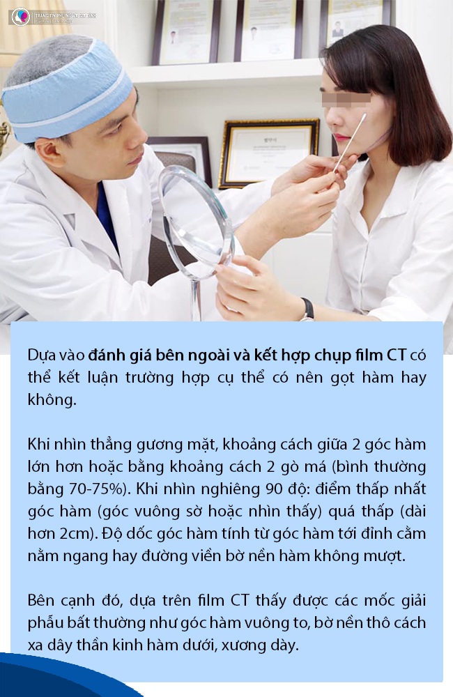 Đang niềng răng có gọt xương hàm, hạ gò má hay trượt cằm được không? - 4