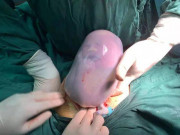 Làm mẹ - Con chào đời hình dáng khác lạ, mẹ khóc thét nhưng bác sĩ nói: "Chị quá may mắn"