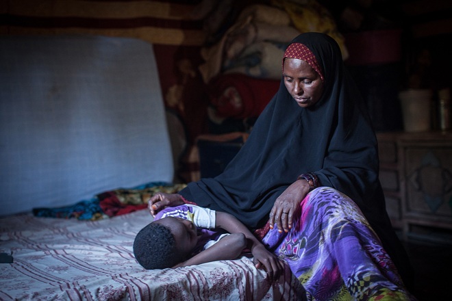 Quy trình cắt amp; # 34; phần dưới amp; # 34; dành cho cô gái: Nỗi đau tột cùng và hành trình thay đổi số phận của một cô gái trẻ - 5