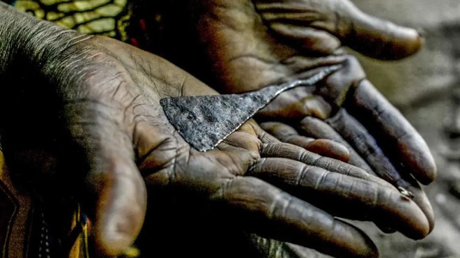 Quy trình cắt amp; # 34; phần dưới amp; # 34; dành cho cô gái: Nỗi đau tột cùng và hành trình thay đổi số phận của một cô gái trẻ - 6