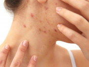 Sức khỏe - 5 dấu hiệu cho thấy độc tố đang âm thầm tích tụ trong cơ thể của bạn, giải độc ngay trước khi quá muộn