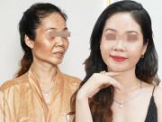 Làm đẹp - Làm đẹp "tái sinh đa tầng", nhiều chị em feedback tốn tiền mà cứ như rửa mặt ở quán gội đầu