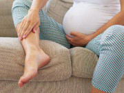 Bà bầu - Món ăn bài thuốc chữa chứng phù thũng khi mang thai