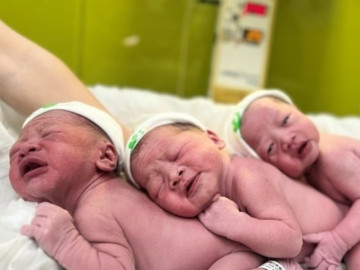 Mẹ bầu sinh 3 con có tổng cân nặng đáng ngạc nhiên gần 7,5kg