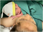 Bà bầu - Bé gái 15 tuổi vào phòng sinh không biết rặn đẻ phải chuyển sang sinh mổ, con chào đời nặng 2,7kg