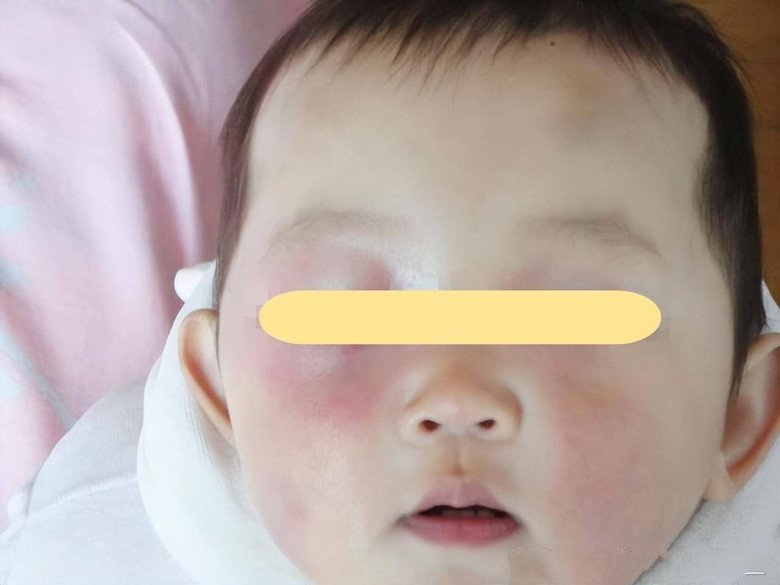 Mẹ lén xem điện thoại khi đang ngủ cùng con, hành động sau đó vô tình khiến đứa trẻ 6 tháng tuổi mất đi thị lực - 2