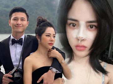 Tốn trăm triệu sửa đi sửa lại chiếc mũi, bạn gái Huỳnh Anh vẫn chưa ưng ý, than thấp lè tè lại to đùng