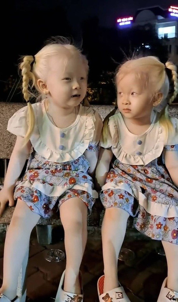 Hai bé gái song sinh bạch tạng ở Sóc Trăng giờ giúp bố mẹ đổi đời: Mỗi tháng làm video kiếm vài chục triệu, khai trương cháy hàng - 3