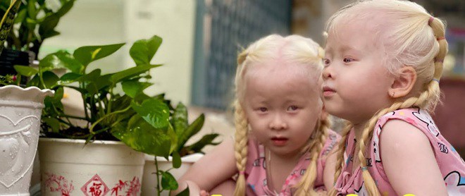 Hai bé gái song sinh bạch tạng ở Sóc Trăng giờ giúp bố mẹ đổi đời: Mỗi tháng làm video kiếm vài chục triệu, khai trương cháy hàng - 13