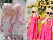 Làm mẹ - Hai bé gái song sinh bạch tạng ở Sóc Trăng giờ giúp bố mẹ đổi đời: Mỗi tháng làm video kiếm vài chục triệu, khai trương cháy hàng