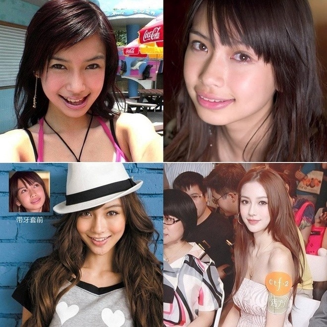 Angelababy bị dùng hình ảnh thời là cô gái răng vẩu để quảng cáo.