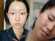 Làm đẹp - 5 dấu hiệu "cầu cứu" của làn da khi dùng sai mỹ phẩm, chị em cần sửa ngay kẻo chưa già đã lão hóa