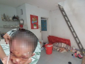 Tin tức 24h: Vụ bé trai nghi bị cha mẹ đánh đập dã man: Người thân cung cấp thông tin bất ngờ