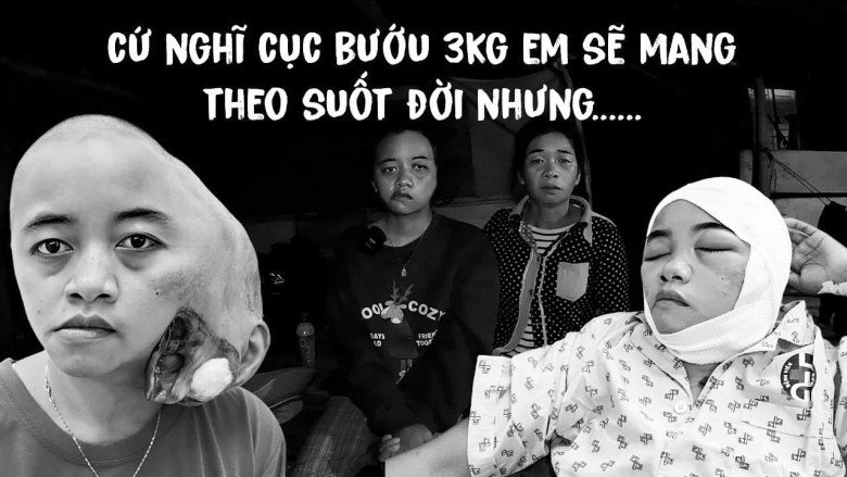 Cô gái trẻ được cha mẹ đặt cho cái tên hàm ý rất xinh đẹp nhưng không may sở hữu amp;#34;mặt quỷamp;#34; và phép màu diệu kỳ khiến tất cả vỡ òa - 1
