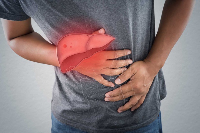 Người đàn ông bị nhiễm sán lá gan sau một thời gian ăn đồ tái sống nhiều và uống nước sông không đun sôi. (Ảnh minh họa)