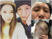 Giải trí - Bị vợ đánh tàn nhẫn không thương tiếc, sao nam nhập viện vì xuất huyết não còn bị mắng oan