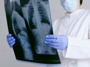 Tái nhiễm Covid-19 nhiều lần người bệnh sẽ chịu nhiều rủi ro về sức khỏe