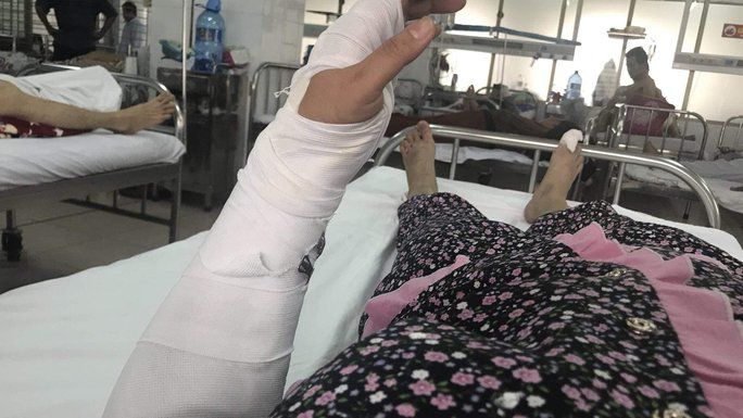 Người vợ phải nhập viện do gãy kín xương trụ tay trái, tổn thương nặng tay phải cùng nhiều vết thương khác. Ảnh: Người Lao Động