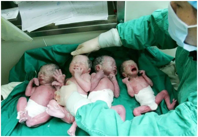 Một cặp đôi khác ở tỉnh Hồ Nam, Trung Quốc cũng sinh 4 đứa con một cách tự nhiên vào năm 2010. Trước đó họ đã có một bé gái đầu lòng.
