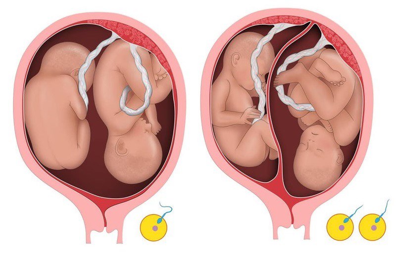 Quá trình phát triển của thai nhi sinh đôi cũng tương tự như các trường hợp mang thai bình thường khác. Tuy nhiên, mẹ bầu sẽ được theo dõi kỹ lưỡng và siêu âm nhiều hơn. 
