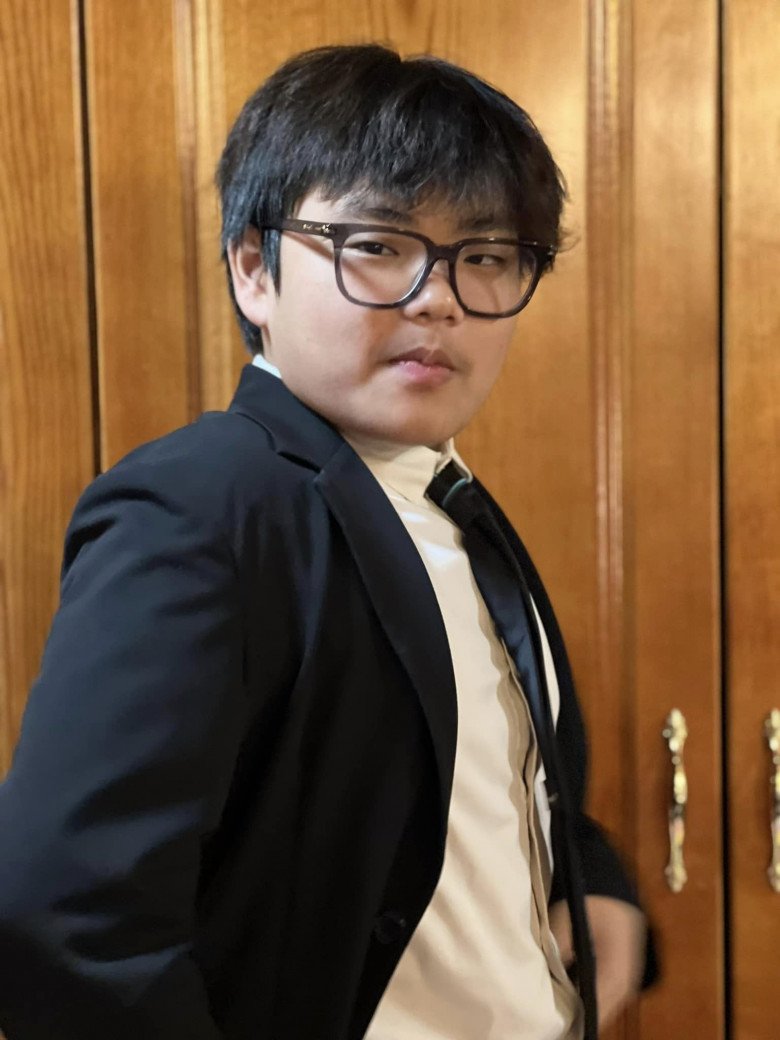 Ở tuổi dậy thì nhưng da của Bi không nổi nhiều mụn mà rất mịn màng. Mẹ ruột dí dỏm nói rằng da mịn nhất Hưng Yên.