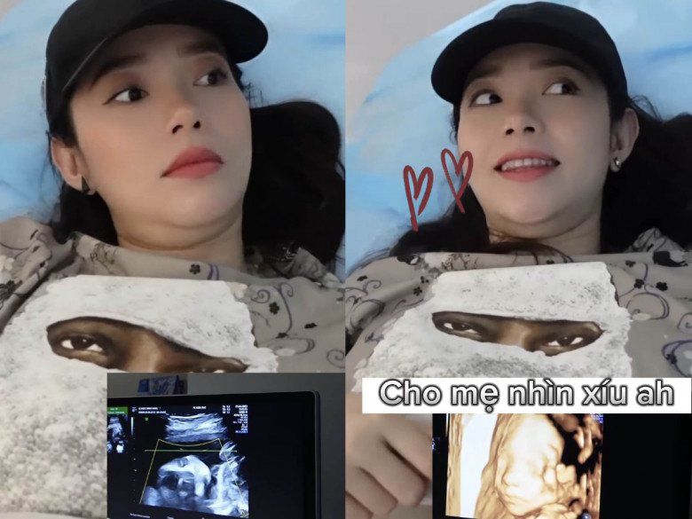 Minh Hằng lần đầu siêu âm 4D để nhìn mặt con.
