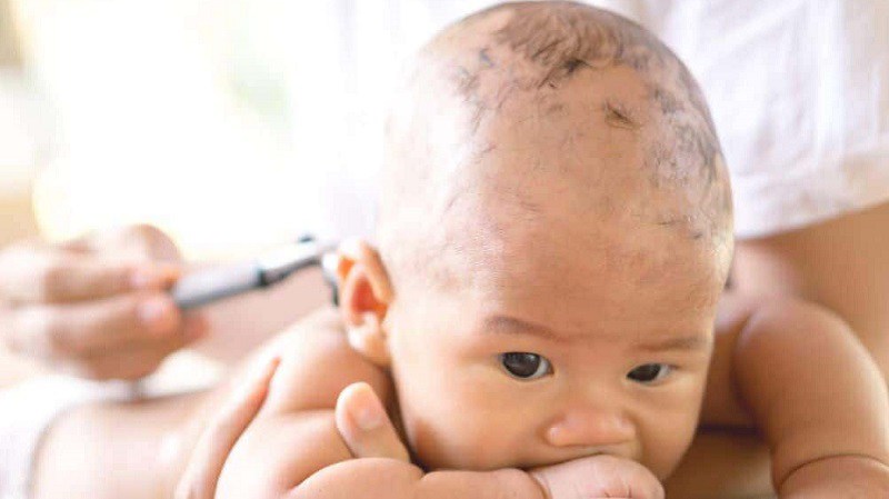 Phần thóp của trẻ sơ sinh thời điểm này có thể chưa hoàn toàn khép. Mái tóc lúc này vẫn còn như một bộ đệm bảo vệ. Nếu mẹ cạo trọc đầu cho bé, toàn bộ mảng da đầu non nớt sẽ lộ ra và rất không an toàn.
