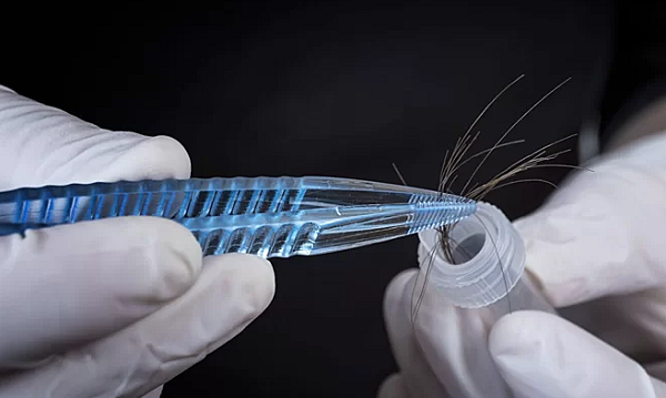 Kết quả xét nghiệm ngoài vấn đề chuyên môn còn phụ thuộc vào việc mẫu được lấy có đảm bảo không. (Ảnh minh họa)