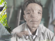 Tin tức - Người đàn ông Cần Thơ được mẹ đặt cho cái tên là "Hận", sở hữu gương mặt xấu xí nhưng lạc quan đến ngưỡng mộ