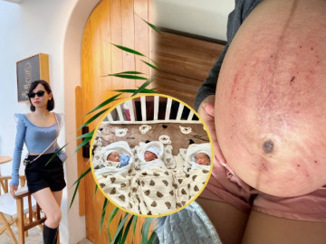 Tưởng bị u nang khó có con, ai ngờ đi siêu âm bác sĩ báo tam thai, mẹ 9X lo nhiều hơn mừng