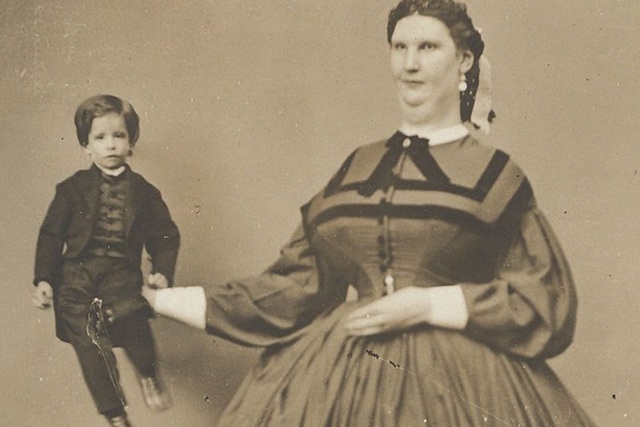 Cuộc đời người phụ nữ có amp;#34;vùng kínamp;#34; đặc biệt nhất thế giới, lấy chồng khổng lồ, sinh con nặng 11kg - 2