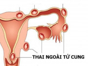Bà bầu - Chu kỳ kinh nguyệt ngắn là bình thường hay dấu hiệu nguy hiểm?