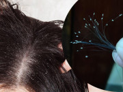 Làm đẹp - "Hoa ưu đàm" bỗng mọc trên đầu, gái xinh bị rụng tóc khóc lóc cầu cứu