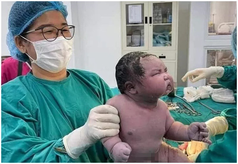 Một bệnh viện phụ sản ở Thái Lan đã chia sẻ khoảnh khắc đầy hài hước khi em bé chào đời với thân hình to lớn và biểu cảm thú vị của em khi nhìn ngắm xung quanh với khuôn mặt cau có cũng thu hút sự chú ý.
