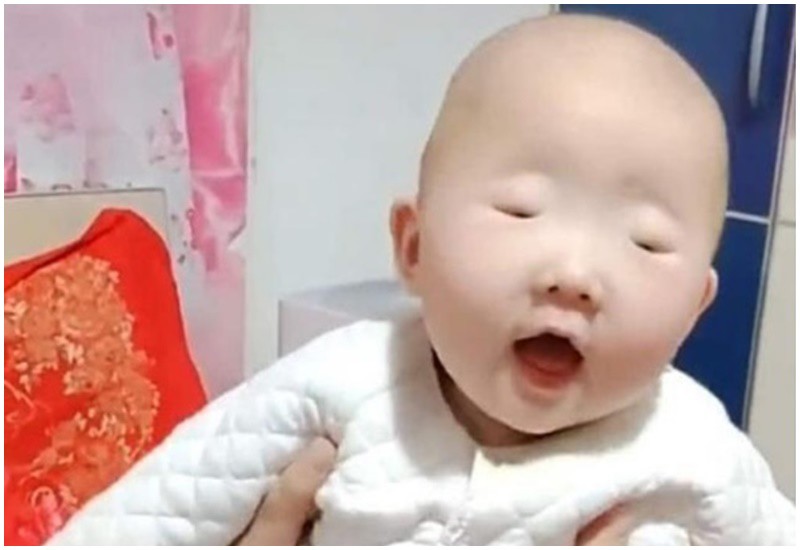 Một em bé mới sinh ở Trung Quốc đã gây chú ý khi có khuôn miệng anh đào nhỏ và làn da đẹp, nhưng đôi mắt bé như hạt đậu xanh.

