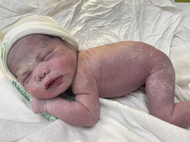 Bé trai chào đời nặng 2,5kg, khóc tốt. Hiện tại 2 mẹ con sức khỏe ổn định. (Ảnh: NVCC)