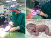 Bà bầu - Bé trai chào đời an toàn với 5 vòng dây rốn quấn quanh cổ