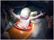 Bà bầu - Những em bé "độc nhất vô nhị", vừa chào đời đã mang đặc điểm không ai có