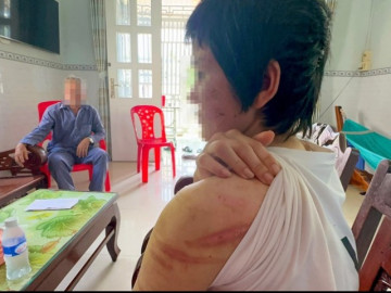 Tin tức 24h: Vụ vợ bầu 7 tháng tố bị chồng bạo hành: Công an mời người chồng lên làm việc