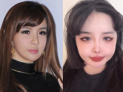 Làm đẹp - Tiếc thay cho Park Bom: Búp bê ngày nào phát tướng, mặt phù, môi căng như củ ấu