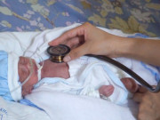 Bà bầu - Sức sống mãnh liệt của em bé sinh non 29 tuần, nặng 600g