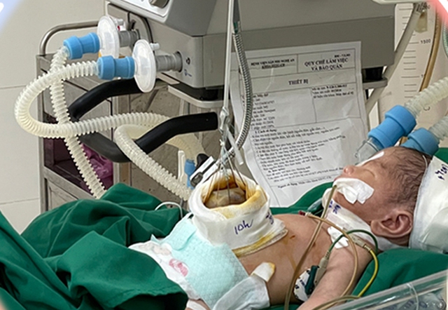 Bé T.M.T. được hồi sức sau phẫu thuật